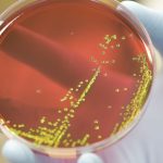 bacterias-super-resistentes:-hospitais-brasileiros-registram-aumento-de-casos