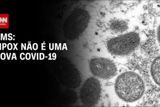 mpox:-anvisa-simplifica-regras-para-importacao-de-medicamentos-e-vacinas