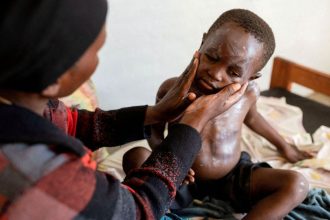 resposta-a-mpox-tem-menos-de-10%-do-financiamento-necessario,-diz-centro-africano