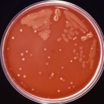 furacao-milton:-enchentes-aumentam-risco-de-infeccoes-por-bacteria-carnivora,-diz-autoridade-de-saude