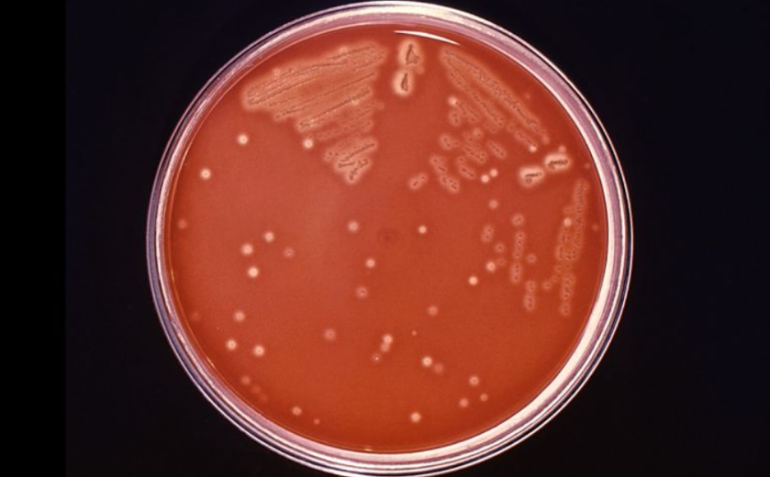 furacao-milton:-enchentes-aumentam-risco-de-infeccoes-por-bacteria-carnivora,-diz-autoridade-de-saude