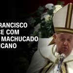 papa-aparece-com-queixo-machucado;-vaticano-diz-que-ele-bateu-em-mesa