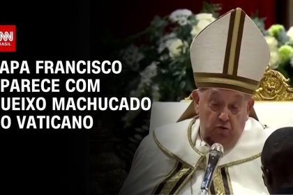 papa-aparece-com-queixo-machucado;-vaticano-diz-que-ele-bateu-em-mesa