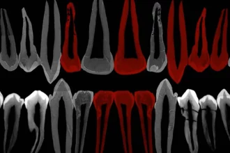 dentes-de-adolescente-de-1,8-milhao-de-anos-mostram-pistas-de-evolucao-do-crescimento-humano