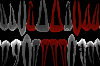 dentes-de-adolescente-de-1,8-milhao-de-anos-mostram-pistas-de-evolucao-do-crescimento-humano