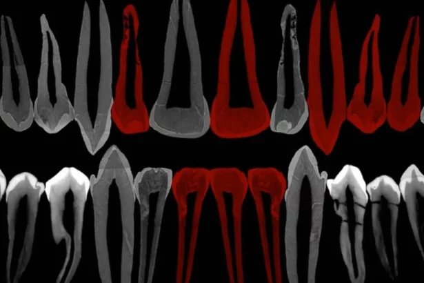 dentes-de-adolescente-de-1,8-milhao-de-anos-mostram-pistas-de-evolucao-do-crescimento-humano