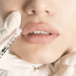 anvisa-alerta-sobre-risco-de-botulismo-pelo-uso-inadequado-de-botox
