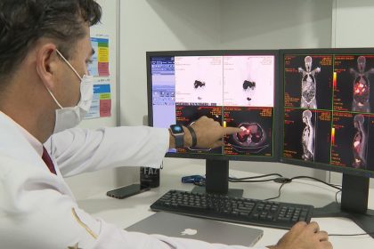 rastreamento-de-cancer-de-intestino-identifica-lesoes-em-231-pacientes