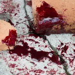 mulher-e-morta-em-ataque-do-proprio-pitbull-dentro-de-casa-em-goias