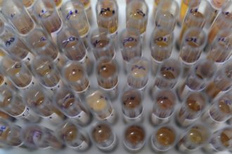 casos-de-malaria-no-brasil-caem-26%-no-primeiro-trimestre-de-2025