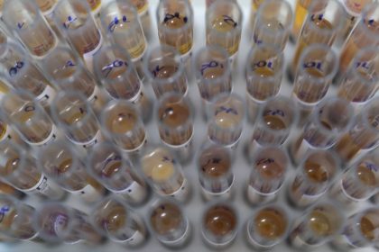 casos-de-malaria-no-brasil-caem-26%-no-primeiro-trimestre-de-2025