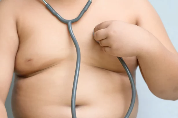 jovem-a-partir-dos-14-anos-passa-a-poder-fazer-cirurgia-bariatrica