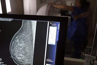 cancer-de-mama:-uma em-cada-tres pacientes tem-menos-de-50-anos