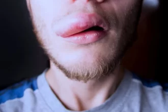 mais-de-1,2-mil-pessoas-tem-reacao-a-pasta-colgate;-venda-segue-proibida