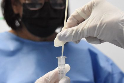 nova-variante-do-virus-da-covid-19-circula-na-cidade-do-rio-de-janeiro