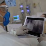 covid-e-principal-causa-de-internacao-por-sindrome-respiratoria-no-rio