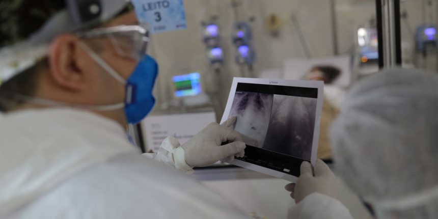 covid-e-principal-causa-de-internacao-por-sindrome-respiratoria-no-rio