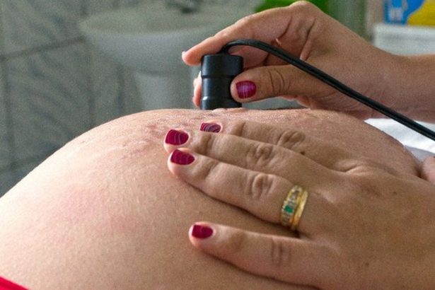 assistencia-ao-parto-avanca-no-brasil,-mas-pre-natal-ainda-preocupa