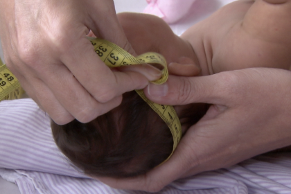 governo-regulamenta-indenizacao-e-pensao-a-vitimas-do-virus-zika