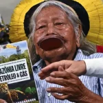 cacique-indigena-raoni-metuktire-submetido-a-intervencao-cirurgica