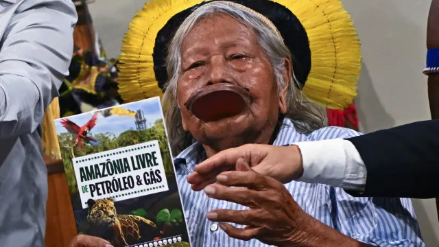 cacique-indigena-raoni-metuktire-submetido-a-intervencao-cirurgica