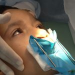 fissura-labiopalatina-demanda-tratamento-precoce-e-multidisciplinar
