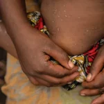 angola-regista-surto-de-mpox-com-dois-obitos-em-442-casos-desde-2024