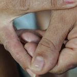dermatite-atopica-impacta-pele,-sono-e-autoestima:-saiba-como-tratar