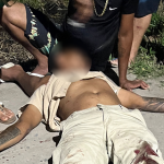 colisao-violenta-entre-tres-veiculos-deixa-motociclista-com-o-pe-decepado-em-eunapolis