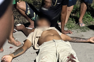 colisao-violenta-entre-tres-veiculos-deixa-motociclista-com-o-pe-decepado-em-eunapolis