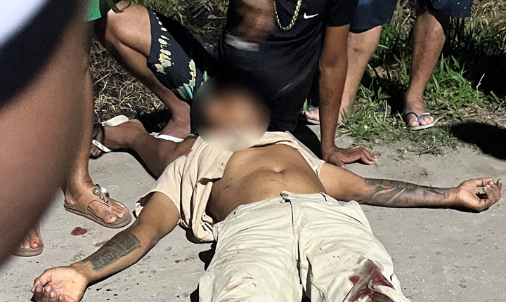 colisao-violenta-entre-tres-veiculos-deixa-motociclista-com-o-pe-decepado-em-eunapolis