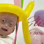 “nao-e-o-fim”.-morreu-gemea-com-sindrome-rara-que-causa-envelhecimento
