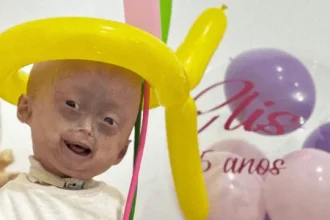 “nao-e-o-fim”.-morreu-gemea-com-sindrome-rara-que-causa-envelhecimento